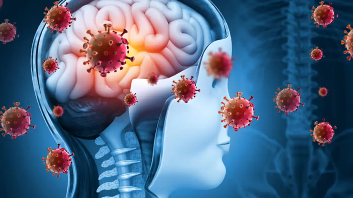 Meningitis Outbreak in England’s Home Counties
