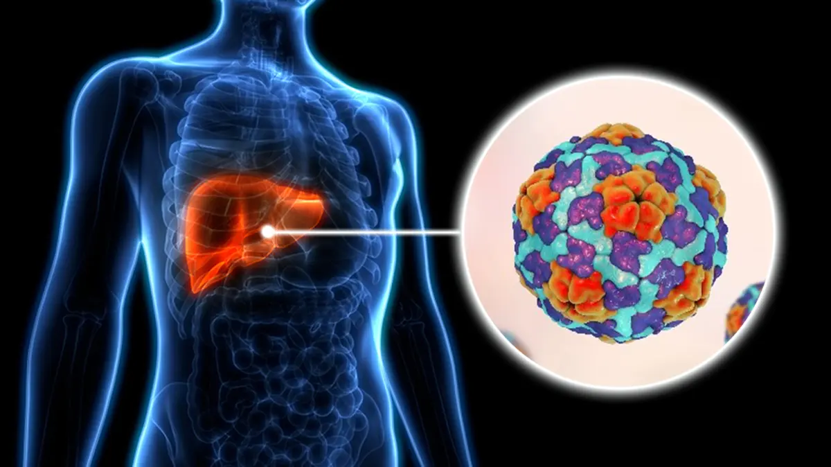 Global Hepatitis Report 2026 Highlights Persistent Burden