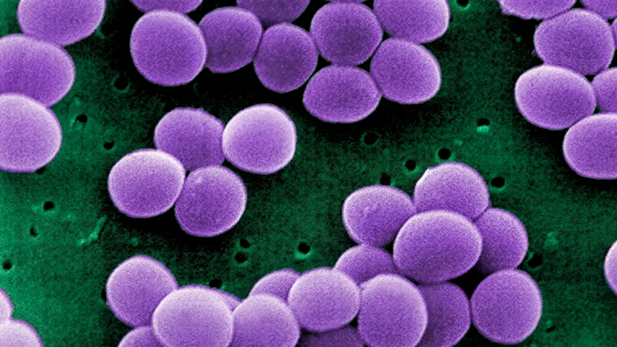 Staphylococcus aureus – Understanding a Common Pathogen