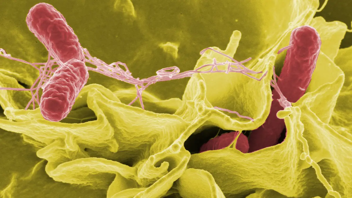 Salmonella Infections: Typhoid, Diseases & Public Health