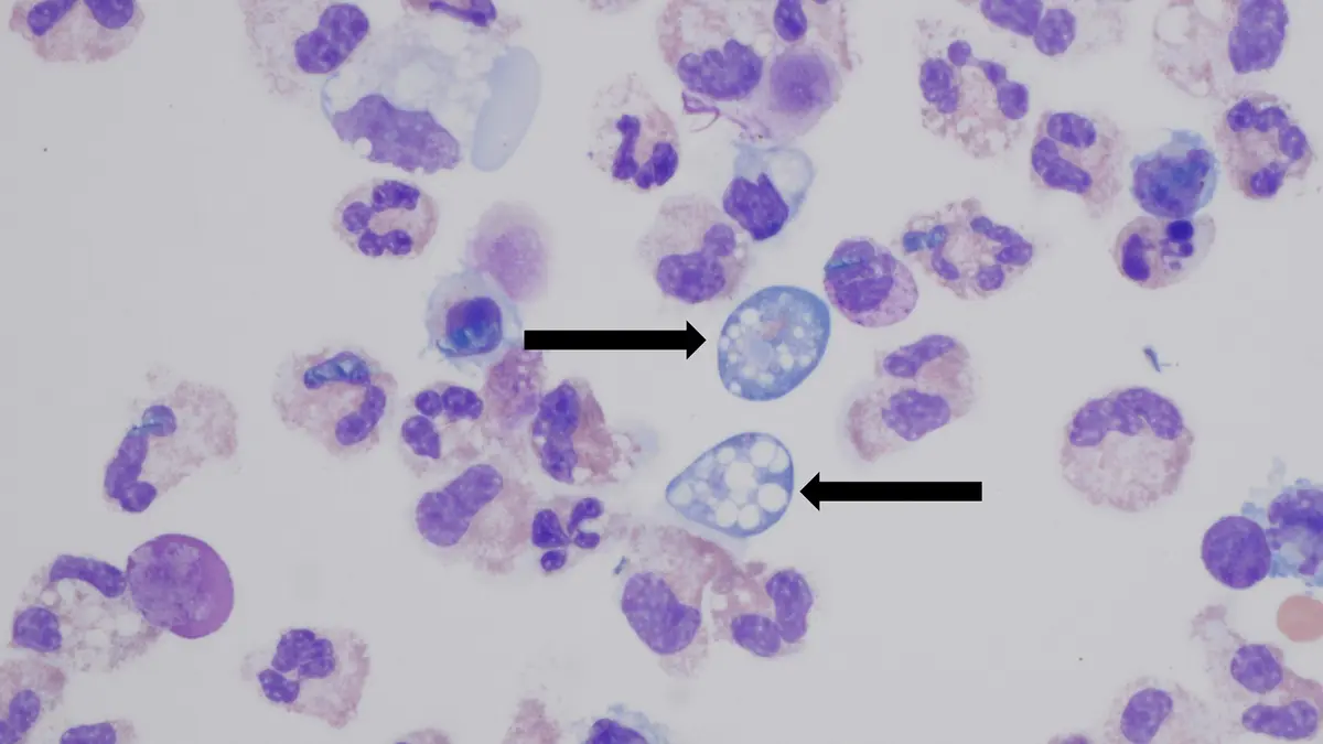 Naegleria fowleri: Why the Amoeba Seeks Out Narrow Channels