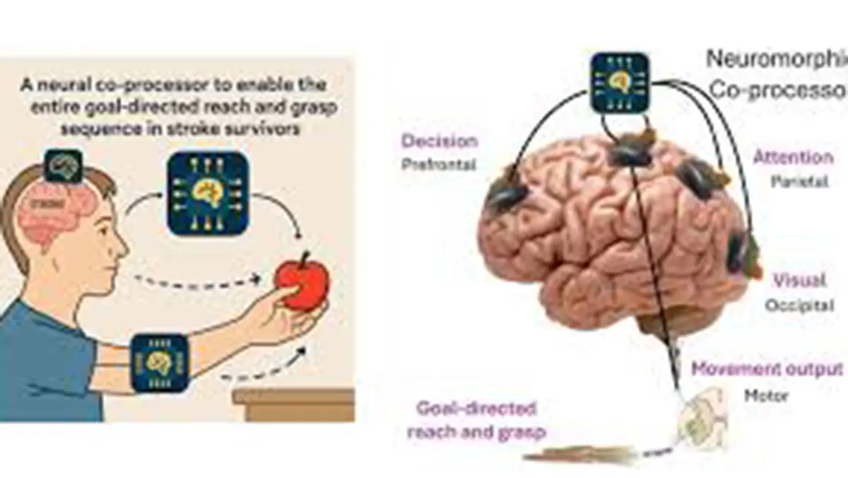 IISc’s Moonshot Project for brain co‑processors