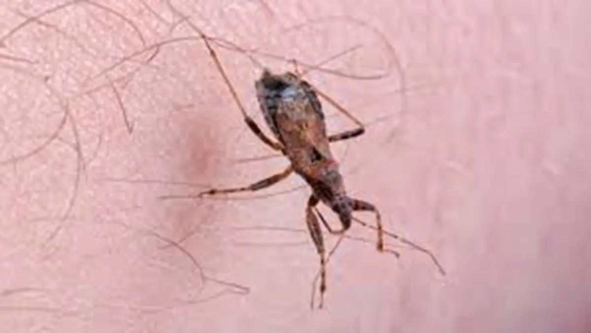 Chagas Disease