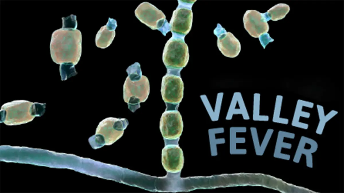 Valley Fever: A Rare but Serious Fungal Infection