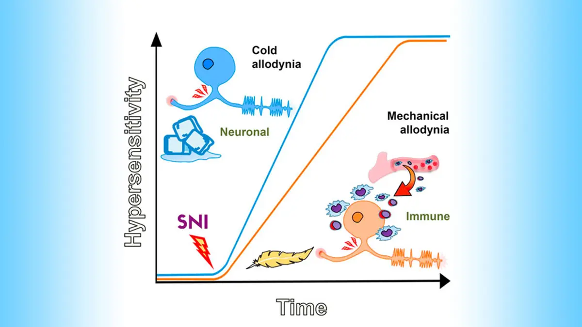 Cold Allodynia: Brain Pathway Behind Chemotherapy Pain