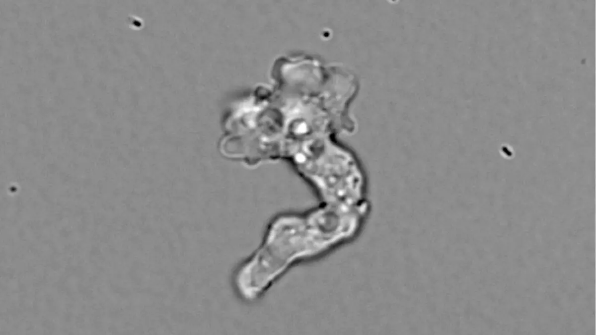 Incendiamoeba cascadensis: Amoeba Divides at 63 Degrees Celsius