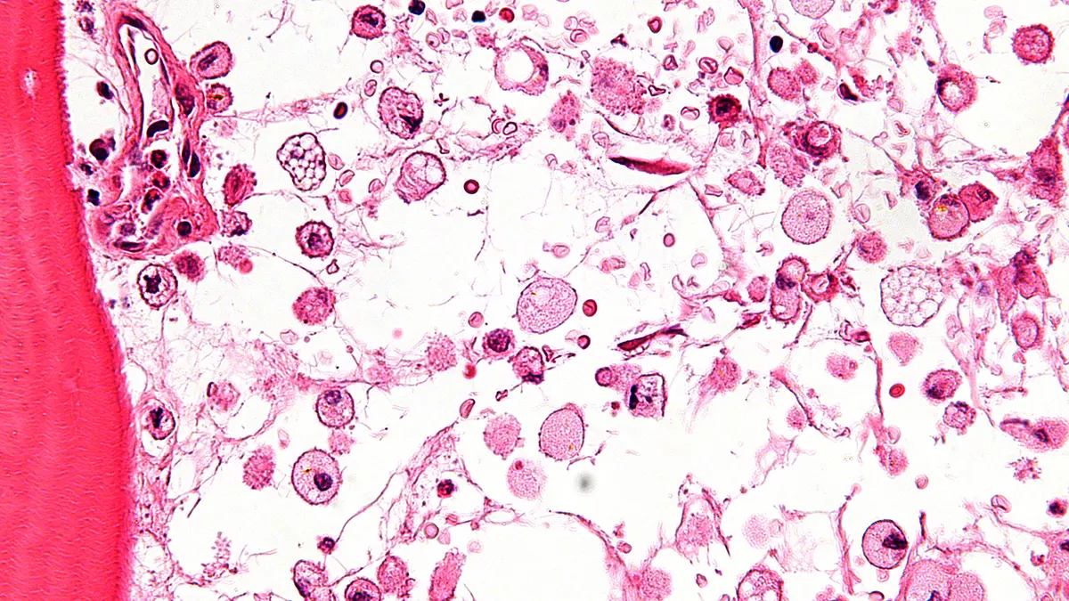 Lysosomal Storage Disorders: India’s First National Biobank