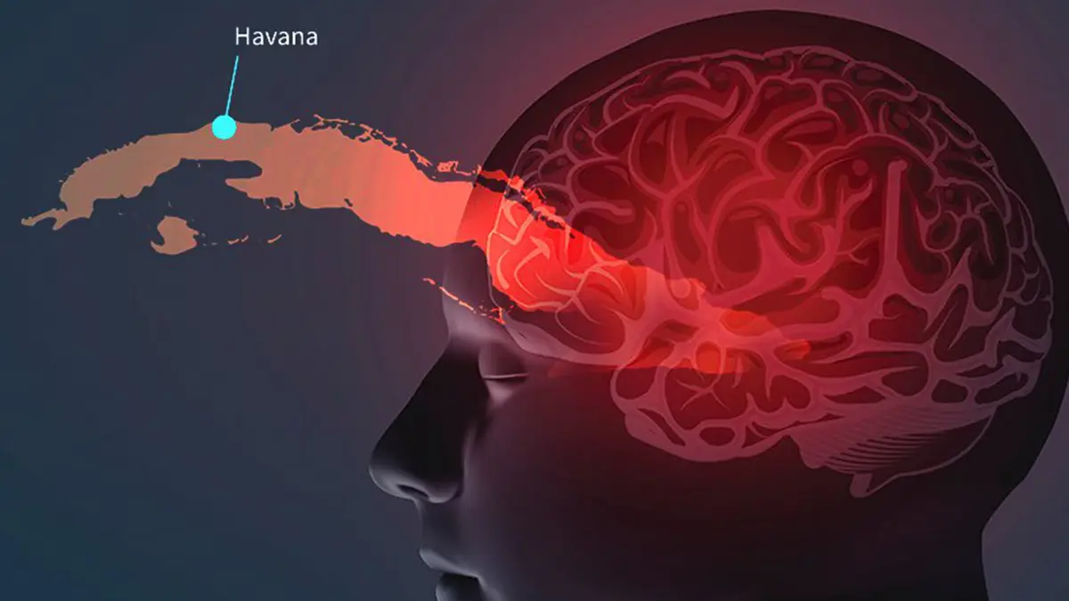 Havana Syndrome and Directed‑Energy Research