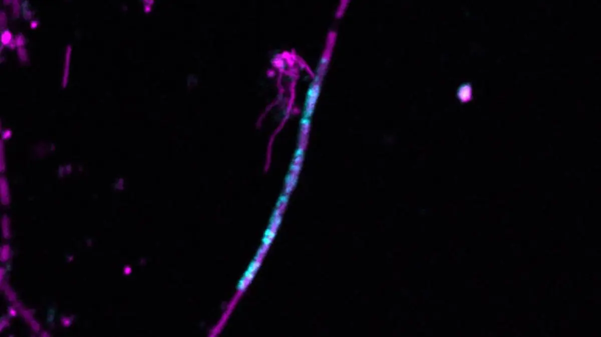 Introns and Horizontal Gene Transfer