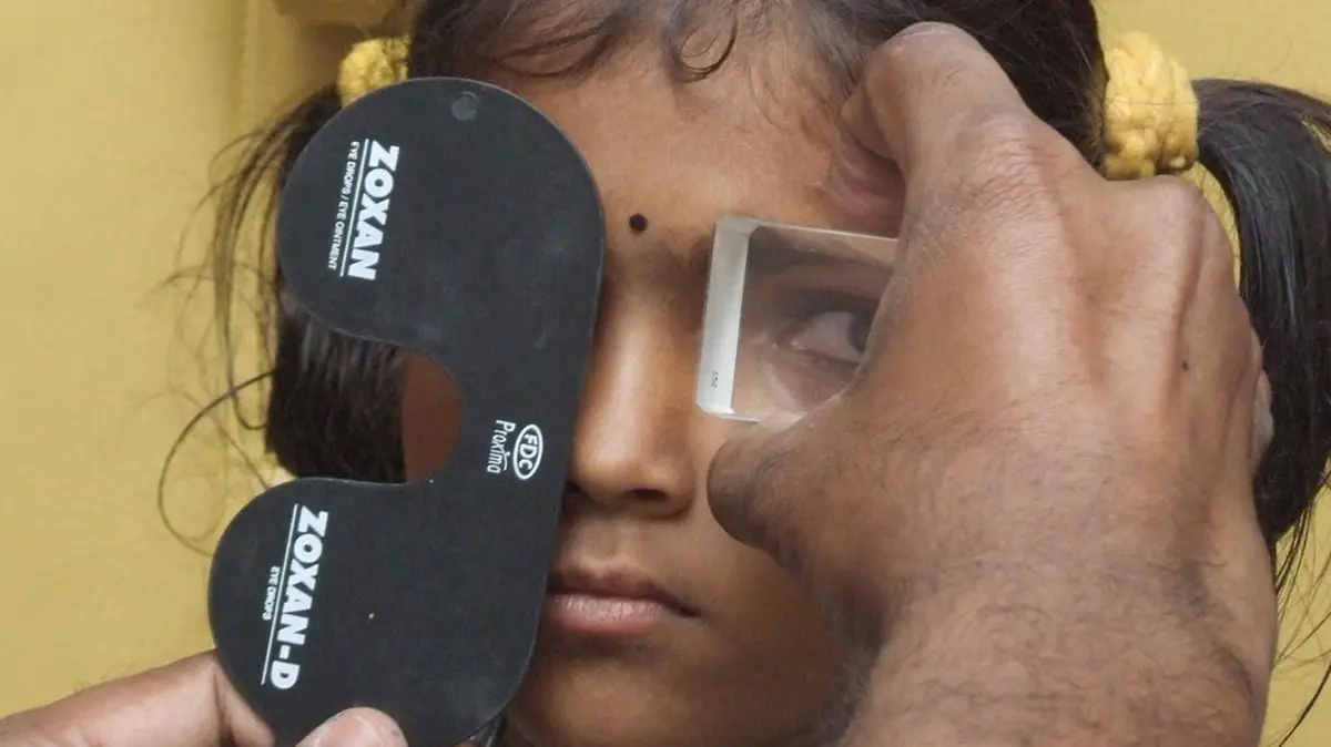 Horizontal Strabismus Affects 1.81 Per Cent of People Globally