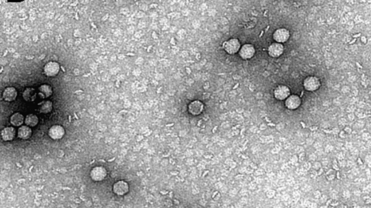 Encephalomyocarditis Virus Claims an African Elephant