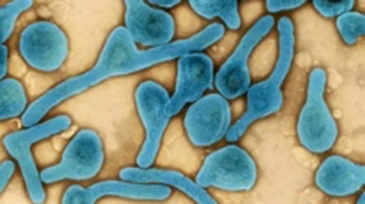 Epstein–Barr Virus – Toward a Vaccine for a Common Infection