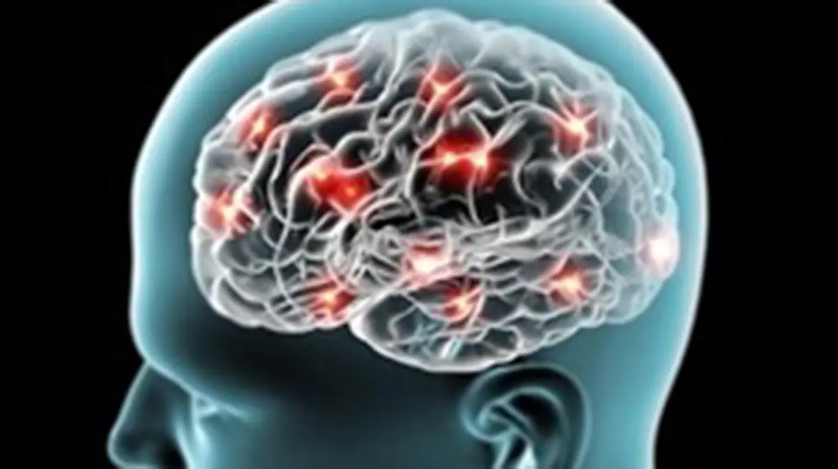 Dopamine Deficiency and Memory Loss in Alzheimer’s Disease