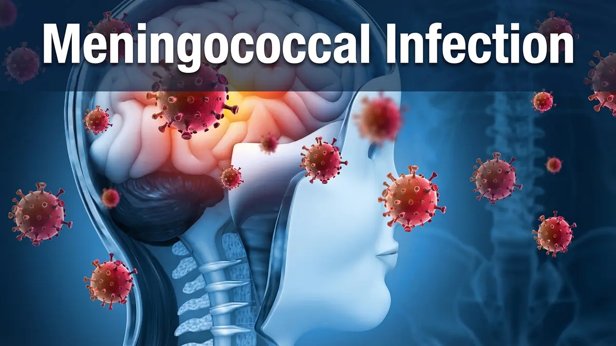 Meningococcal Infection – Health Advisory in Meghalaya
