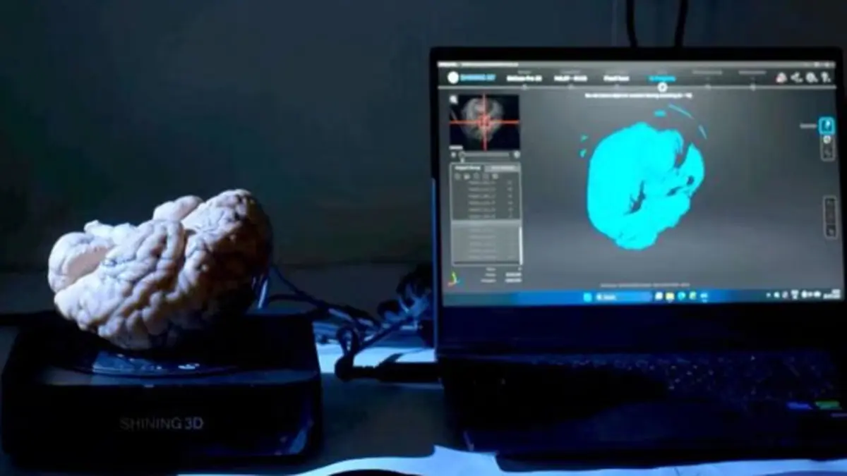 ANCHOR – 3D Atlas of the Human Brainstem