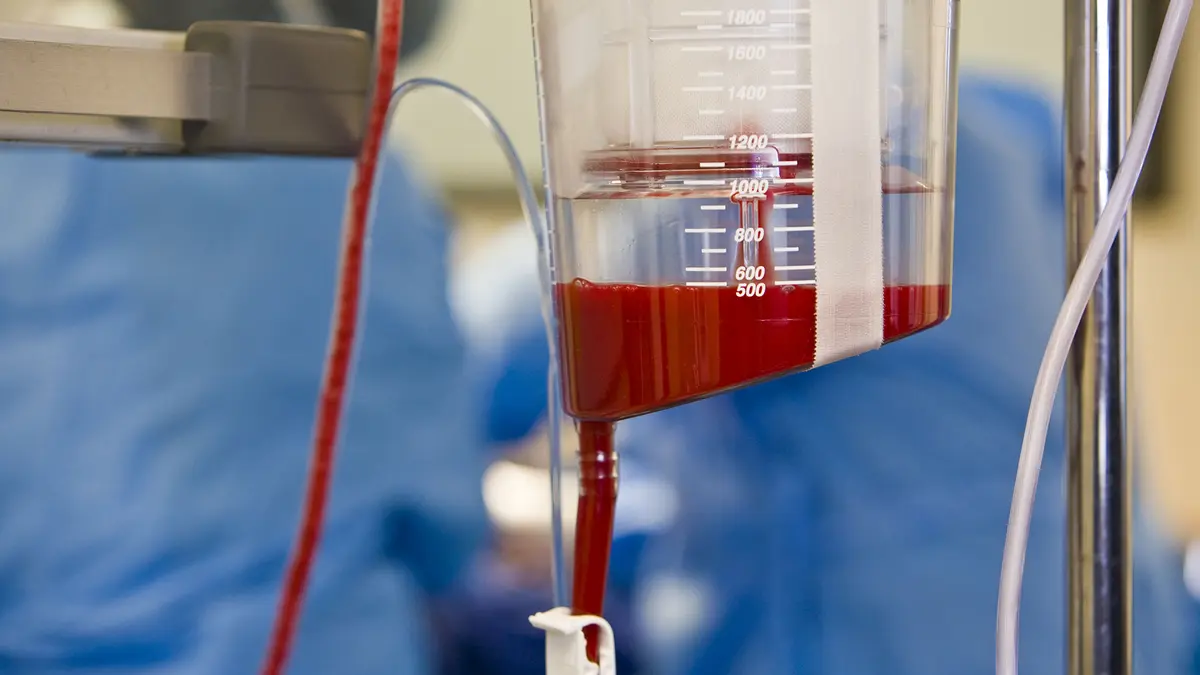 Forever Chemicals (PFAS) – Persistent Pollutants and Health Risks