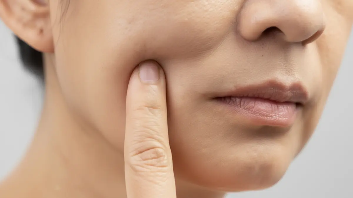 Alcohol Intake and Buccal Mucosa Cancer