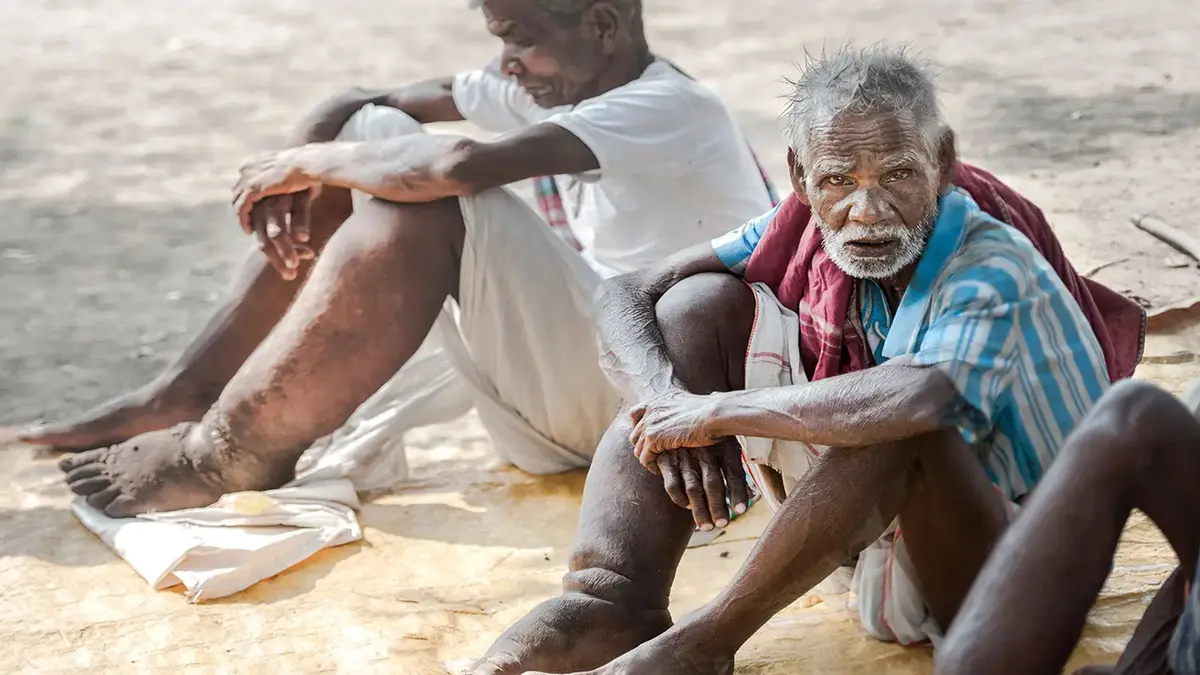 Lymphatic Filariasis