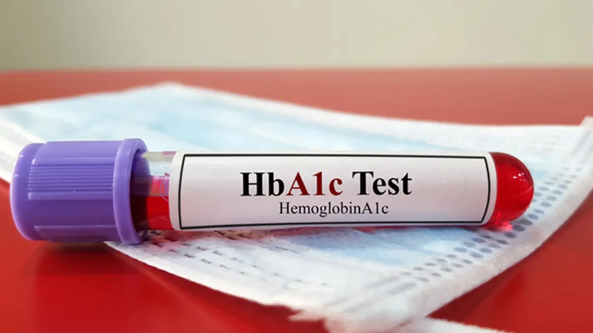 HbA1c test and its limitations in detecting diabetes