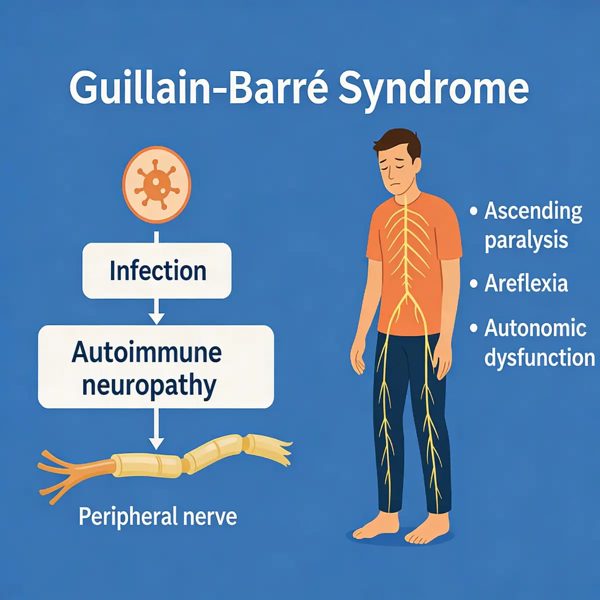 Guillain–Barré Syndrome (GBS)