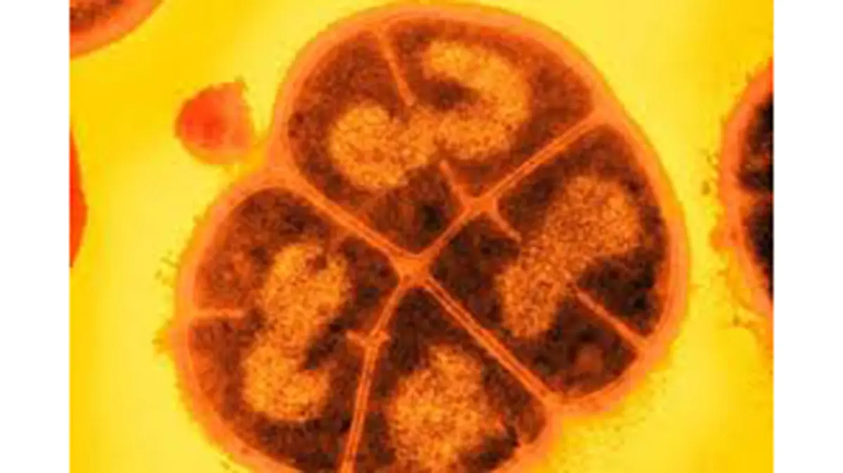 Hardy microbe survives asteroid‑like pressures