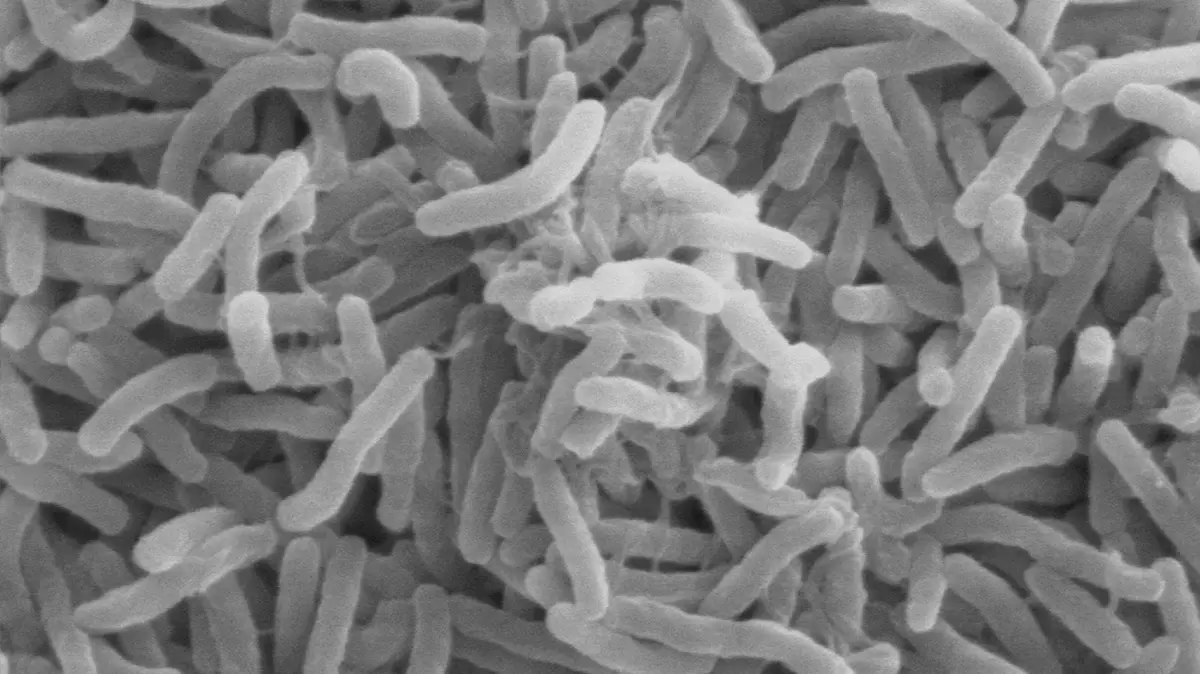 Cholera: Causes, Treatment & Global Burden of the Disease