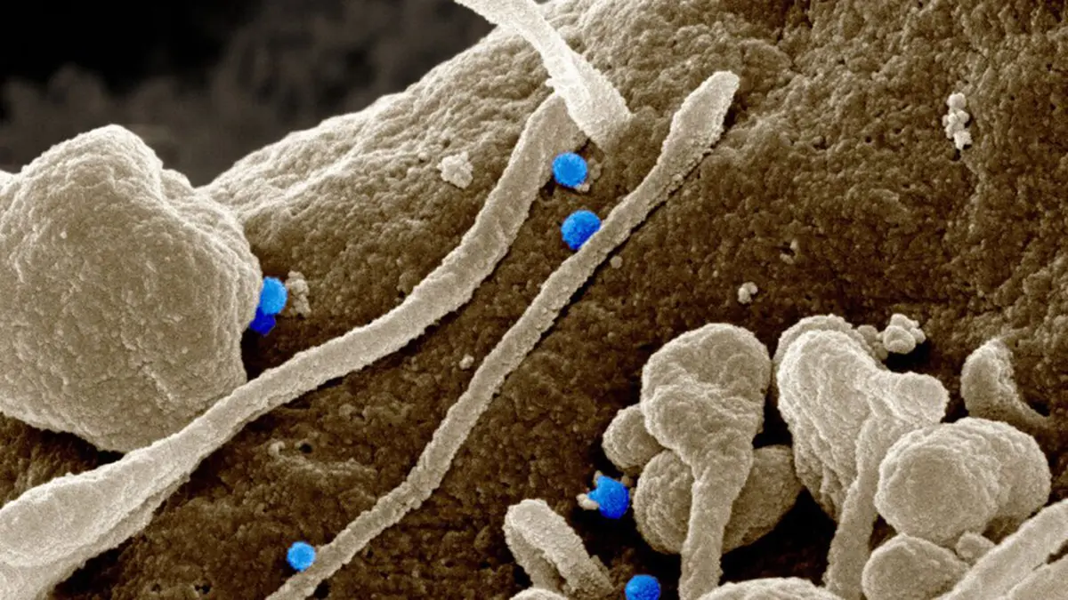 Study Maps Four Antibody Targets on the CCHF Virus Protein