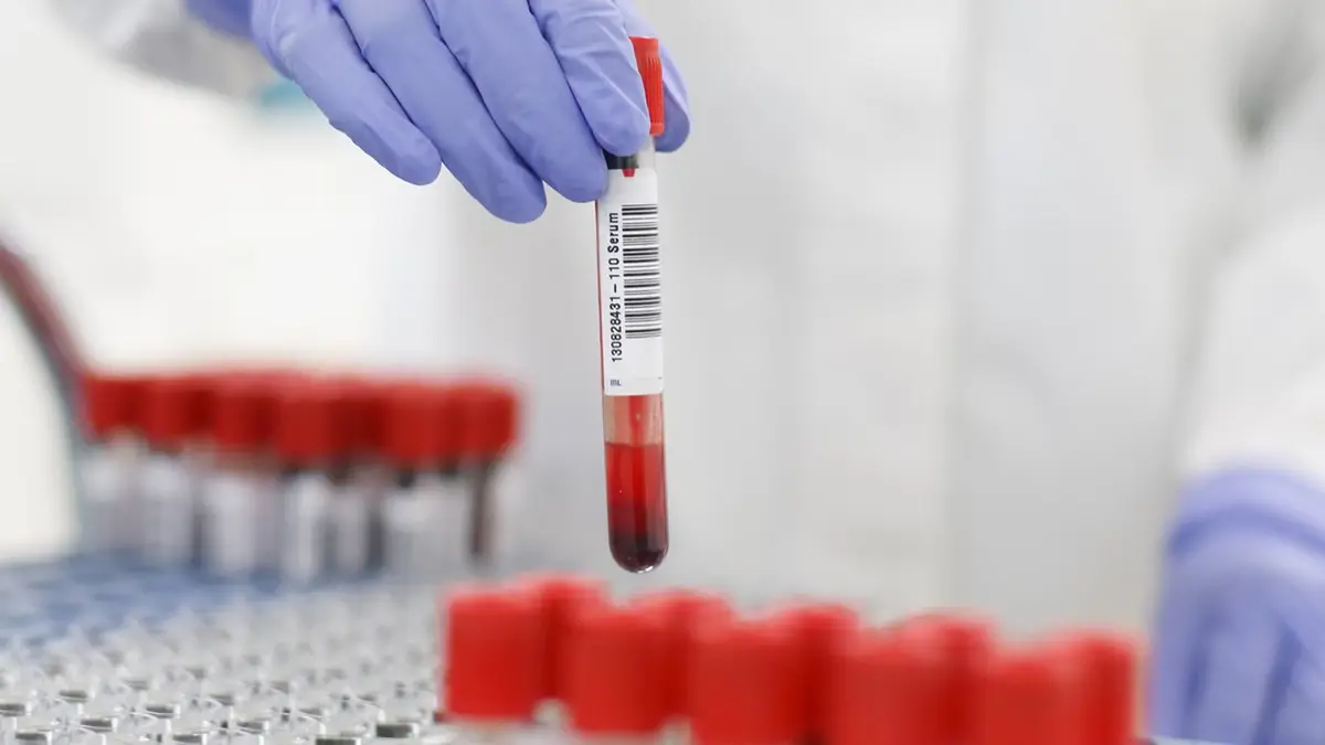 Nucleic Acid Test (NAT) for Blood Transfusion - Explained