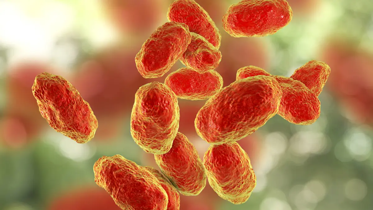 Haemophilus influenzae type b (Hib) Disease